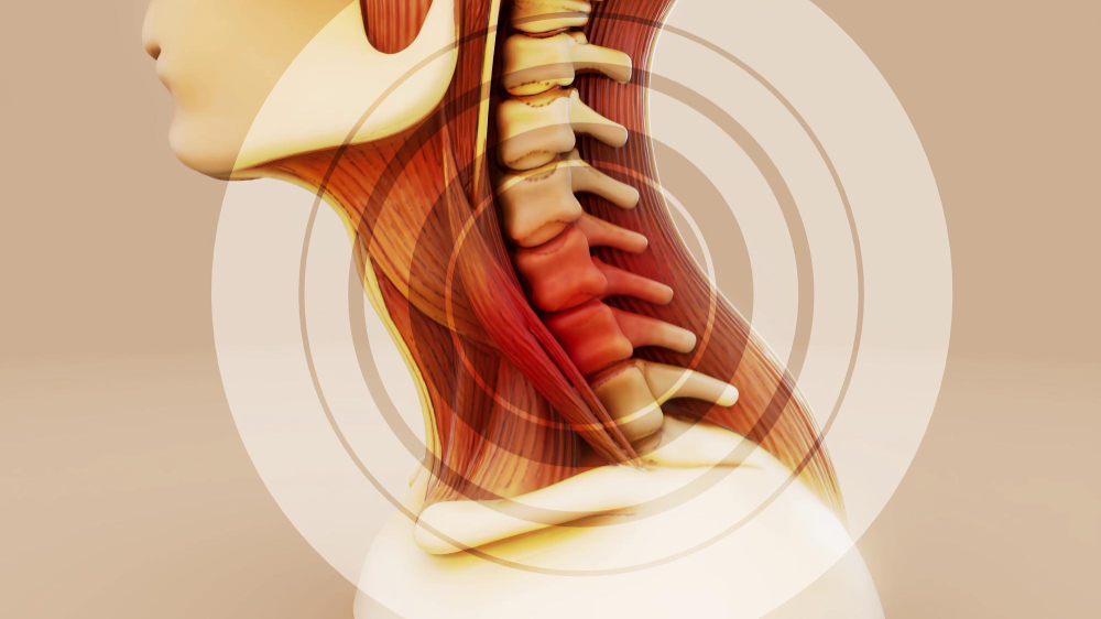 Rigidità Cervicale e Tensione al Collo: Valutazione Chiropratica a Torino